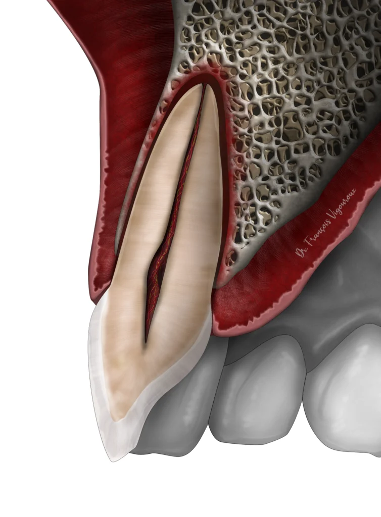 Subluxation